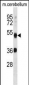 ATG4B Antibody (N-term)