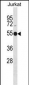 ATG4C Antibody (N-term)