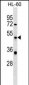 ATG4D Antibody (N-term)