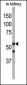 ATG4D Antibody (Center)