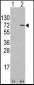 ATG4D Antibody (Center)