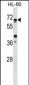 ATG4D Antibody (Center)