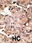 ATG4D Antibody (C-term)