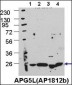 ATG5 Antibody (C-term)