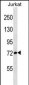 ATG7 Antibody (N-term)