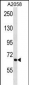 ATG9A Antibody (Center)