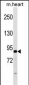 ATG9A Antibody (Center)