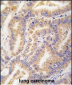 ATG12 Antibody (N-term)