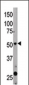 Beclin 1 Antibody