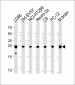 UCHL1 Antibody (C-term)