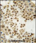 Parkin Antibody (C-term)