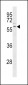 Parkin Antibody (C-term)