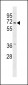 PINK1 (PARK6) Antibody (Center)