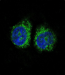 NURR1 (NR4A2) Antibody (N-term)