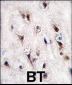 NURR1 (NR4A2) Antibody (N-term)