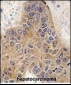 STUB1 Antibody (C-term)