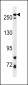 PARK8 (LRRK2) Antibody (L893)