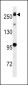 PARK8 (LRRK2) Antibody (L955)