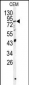 PAPSS1 Antibody (N-term K9)