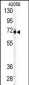 PAPSS1 Antibody (C-term A607)