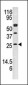 AK3 Antibody (N-term F210)