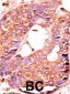 PPP6C Antibody (N-term)