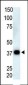 PPP6C Antibody (N-term)