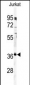 PPP6C Antibody (C-term)