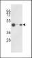 KAT1 (HAT1) Antibody (C-term)