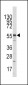 KAT5 / Tip60/HTATIP Antibody (N-term)