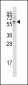 KAT5 / Tip60/HTATIP Antibody (N-term)