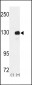 RENT1 Antibody (N-term)
