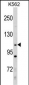 MLLT10 (AF10) Antibody (Center)