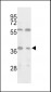 IsocitRe dehydrogenase (IDH3) Antibody (C-term)