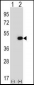 EIF2B3 Antibody (C-term)