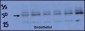 DSCR1 Antibody (Center)