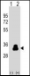 Kallikrein 4 (KLK4) Antibody (Center)