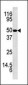 Kallikrein 5 Antibody (Center)