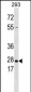 Kallikrein 5 Antibody (Center)