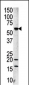 Aurora-A Antibody (C-term)