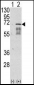 Activin Receptor Type IA (ACVR1) Antibody (Center N153)