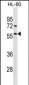 Activin Receptor Type IA (ACVR1) Antibody (Center N153)