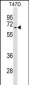 Activin Receptor Type IA (ACVR1) Antibody (Center N99)