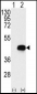 BCKDK Antibody (Center)