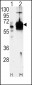 Guanylyl Cyclase alpha 1 (GUCY1A3) Antibody (N-term)