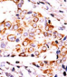 NME3 Antibody (Center)