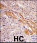 PGK1 Antibody (Center S320)