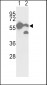 Pyruvate Kinase (PKM2) Antibody (C-term)