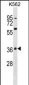 MAPK11 Antibody (C-term)