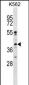 MAPK11 Antibody (Center)